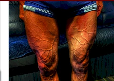 Ciclista mostra pernas após 4 horas de treino e impressiona fãs
