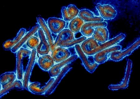 Prefeitura de Campo Grande emite alerta para vírus da família do Ebola, de alta letalidade