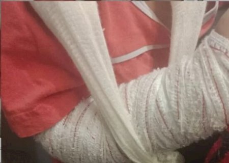 Mãe cria vaquinha social para arrecadar R$ 7 mil e custear cirurgia do filho