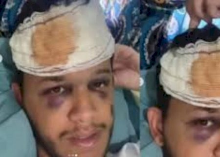 Cantor sertanejo sofre traumatismo craniano após acidente depois de show em Mato Grosso do Sul