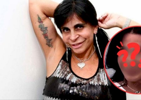 Gretchen exibe ‘novo rosto’ e choca internautas: ‘A cara da Ana Castela’