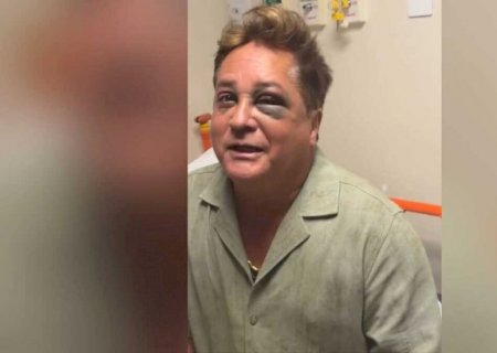Leonardo exibe olho roxo ao cair de barco em pesca no Pantanal de MS: 'não riam' (vídeo)