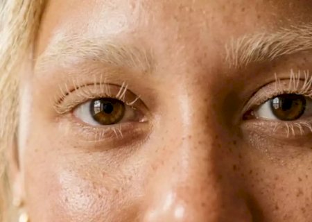Você sabia que descolorir cílios pode perfurar os olhos?